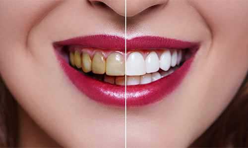 odontología estética dental en Villa Carlos Paz